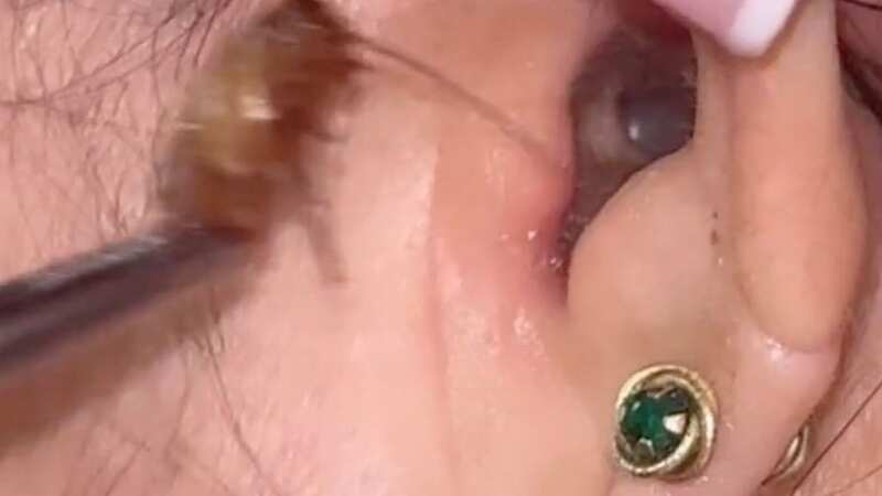 The woman had complained of a strange popping sensation (Image: Jam Press/@paulaavalos)