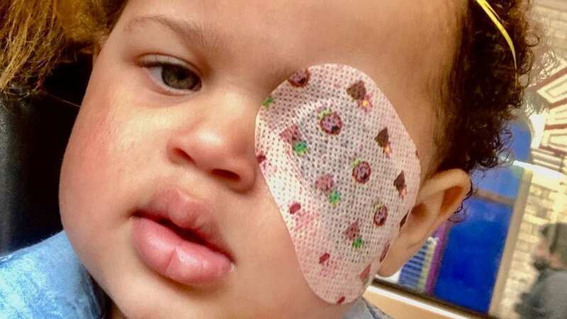 Amelia had her left eye removed after being diagnosed with a rare form of eye cancer (Image: The Childhood Eye Cancer Trust / SWNS)