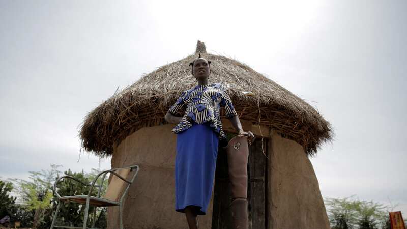 Winnie Keban now wears a prosthetic leg after she was ferociously attacked by a crocodile (Image: AP)