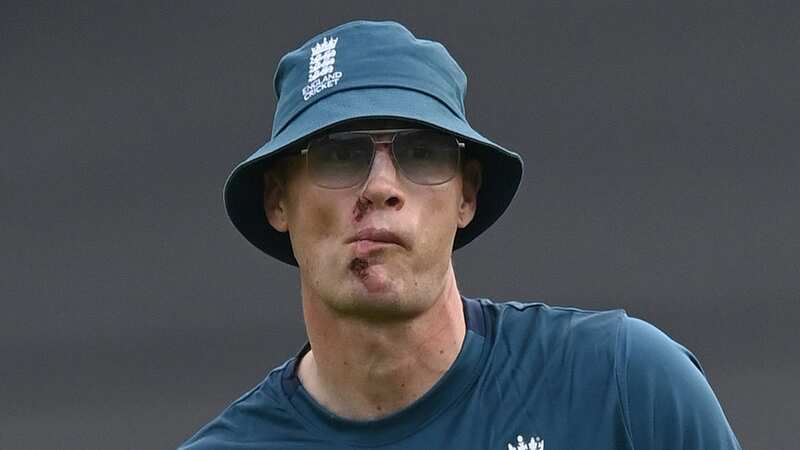 The former cricket ace was left with very visible injuries (Image: Popperfoto via Getty Images)