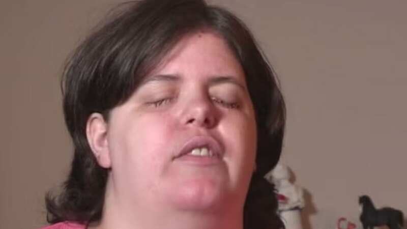 Jewel Shuping blinded herself on purpose (Image: Barcroft Media/ YouTube)