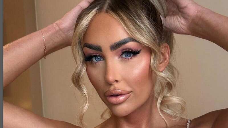 Ella is getting her lip filler dissolved (Image: Instagram)