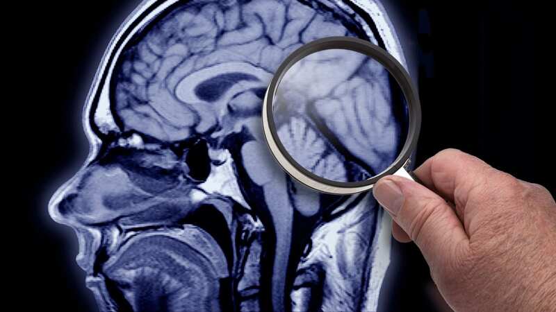 A common health issue we can all face has been linked to developing Alzheimer