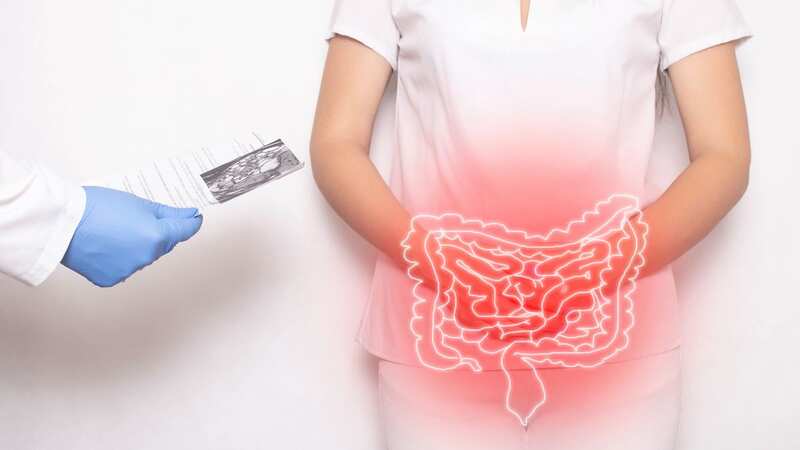 Crohn