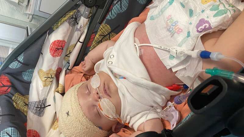Hattie was diagnosed with a rare condition (Image: Bull family/BPM Media)