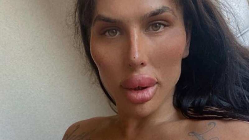 Sofia said she nearly died but the surgery was worth the result (Image: Jam Press/@sofia.lipsx)