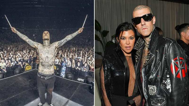 Gruesome Travis Barker photo shows 