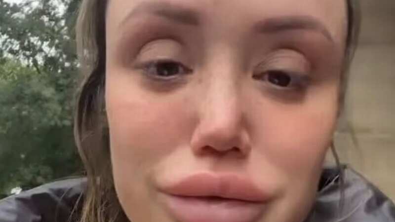 Charlotte Crosby admits she