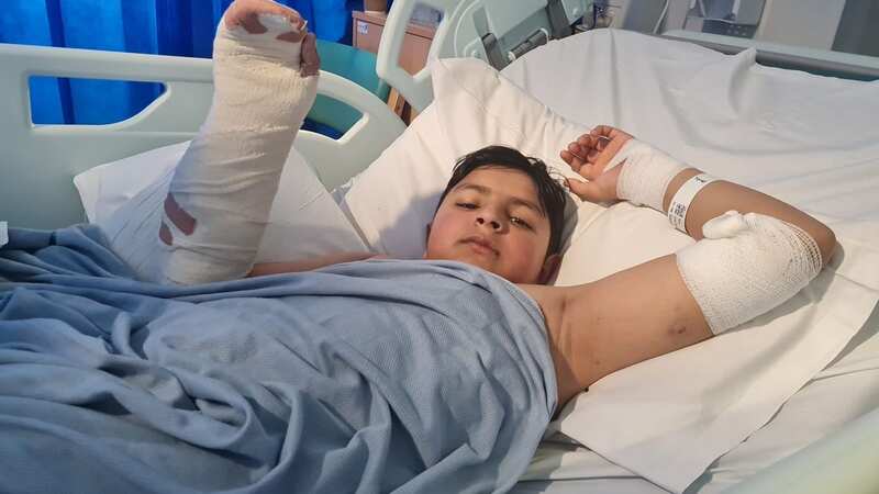Mohid Gardazee, 12, is in hospital after he was mauled by a dog in the street (Image: Ahmad Gardazee / SWNS)
