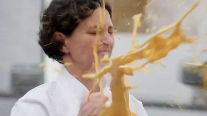 MasterChef contestant quits show after suffering painful burns during challenge