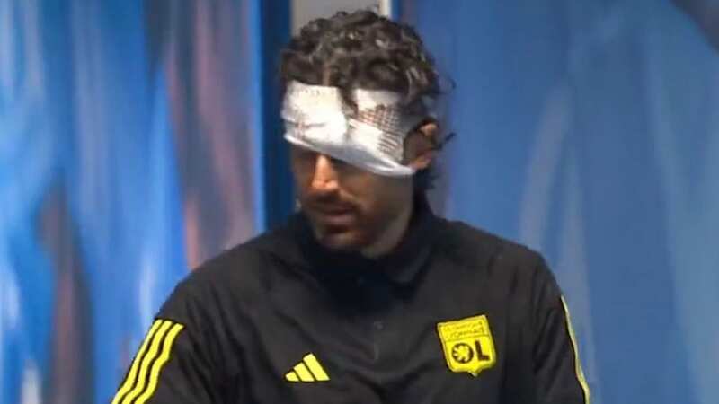 Football manager shows brutal injuries suffered in bus attack on way to match