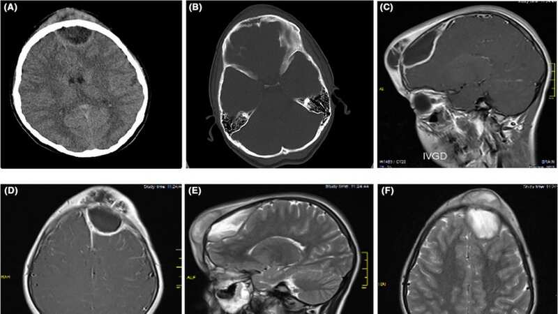 Scans of the brain are featured in a research document called Clinical Case Reports (Image: Wiley)