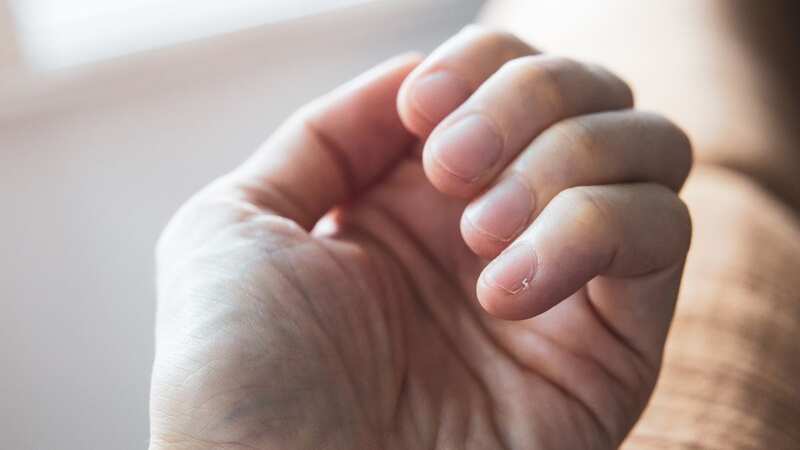 Our nails can tell al lot about our health (stock image) (Image: Getty Images)