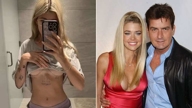 Sami confirmed she’d gone under the knife