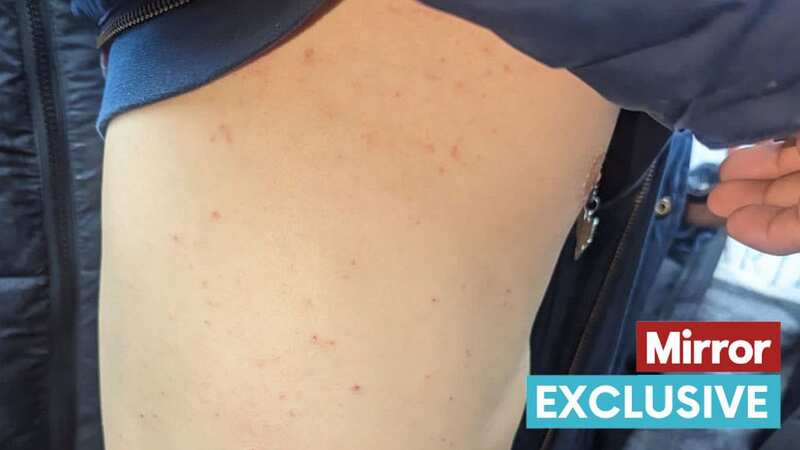 The Home Office confirmed a case of scabies at Wethersfield in July (Image: Getty Images)