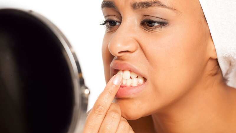 Black triangles could be a sign of things that need treating (Stock Image) (Image: Getty Images/iStockphoto)