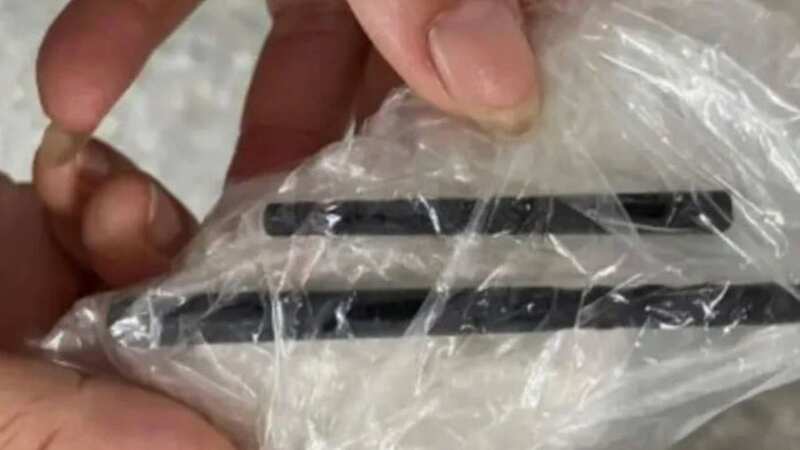 The chopsticks lodged inside the patient