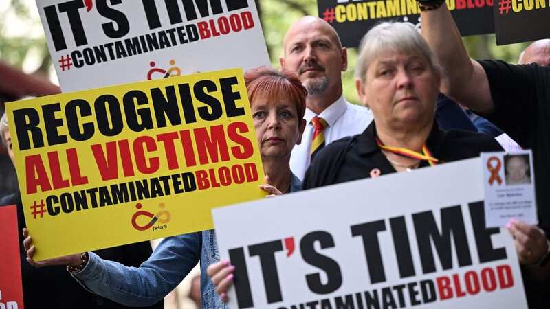 Rishi Sunak has suffered a humuliating Commons defeat over the blood scandal (Image: AFP via Getty Images)