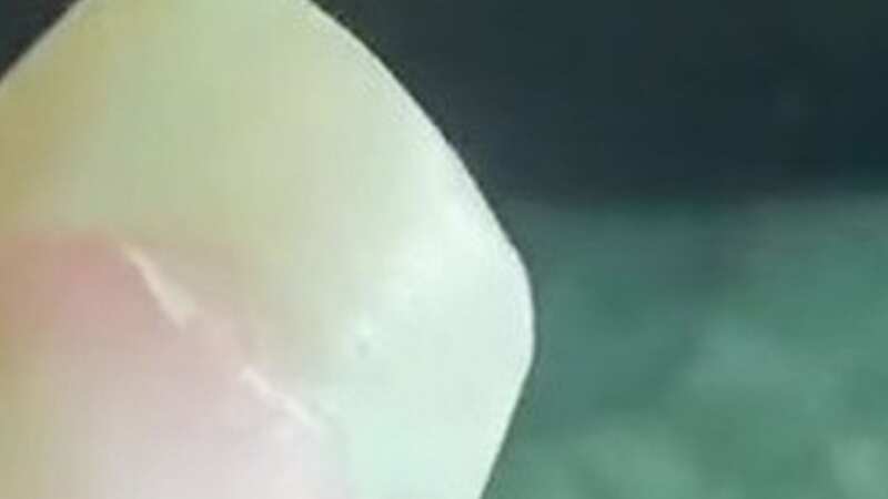The woman was mortified when the green spots appeared on her nails (Image: Kennedy News/@pheebs_elizabeth)