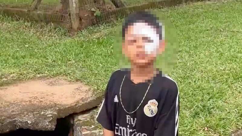 Raphael Levi dos Santos Rocha., whose eye was injured in the freak accident (Image: Jam Press)