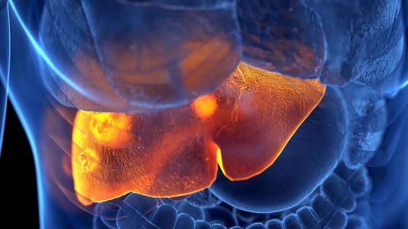 Dr Eric Berg says there are clues in your feet you could have liver problems (Image: Dr Eric Berg/YouTube)