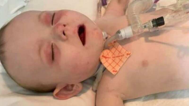 Family blasts police after toddler ends up in ICU in 