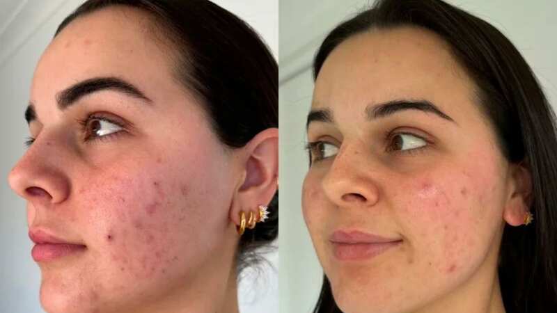 You can check out some amazing results online!