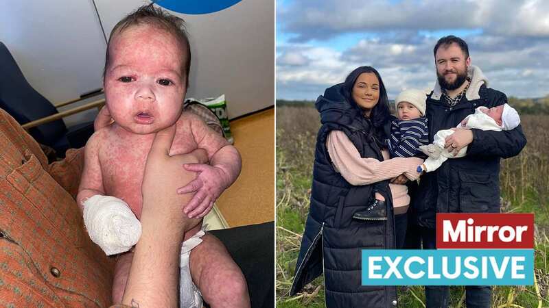 Baby Ezra was rushed to A&E when a red spotty rash develop all over his body (Image: Davina Barrett)