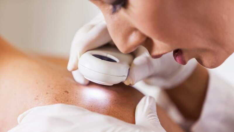 Your skin can tell you a lot about your health (stock photo) (Image: Getty Images)