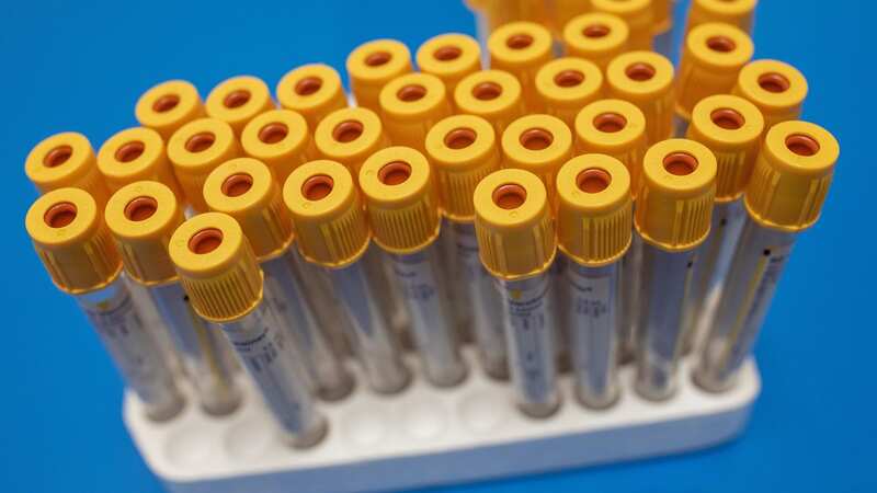 There has been a surge in measles cases across Europe (Image: PA Archive/PA Images)