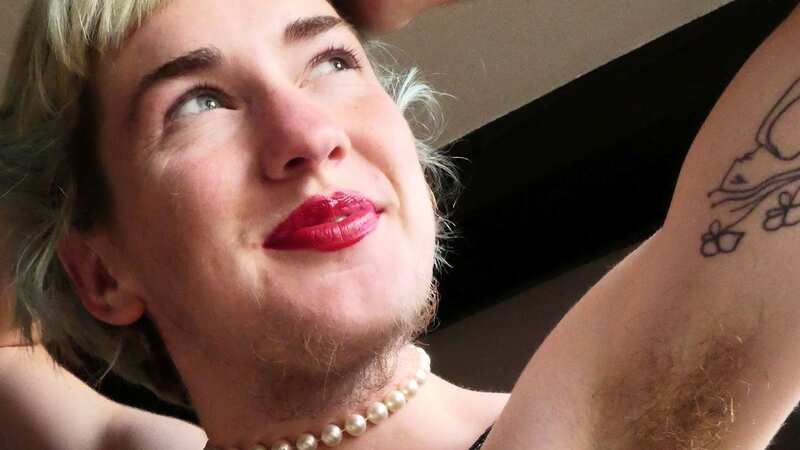 A woman who spent £51k removing her body and facial hair has now embraced it – despite being mistaken for a man (Image: Bethany Burgoyne / SWNS)
