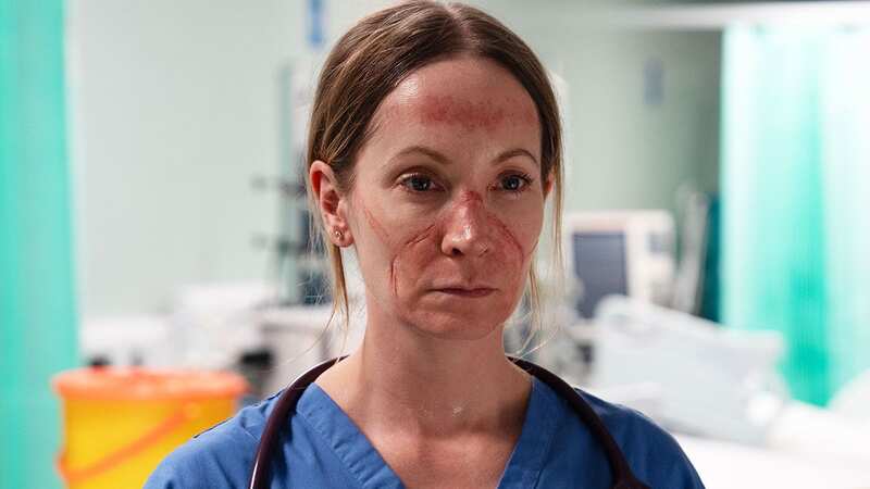 Breathtaking viewers were left divided after the first episode