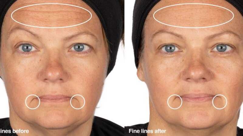 Before and after results from using Nip + Fab