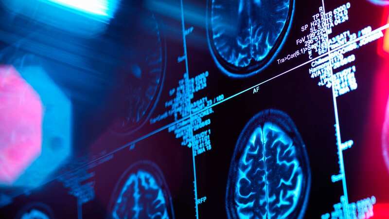 The breakthrough study found where four common disorders pop up in the brain, which can be used to develop better remedies (Image: Getty Images/Cultura RF)