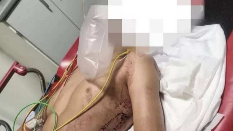 The boy was found in a pool of blood when the alarm was raised