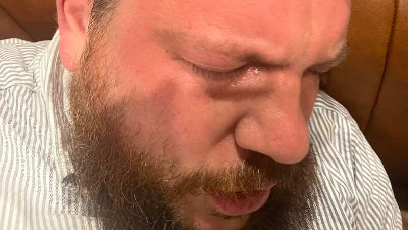 A brutal attack on Alexei Navalny