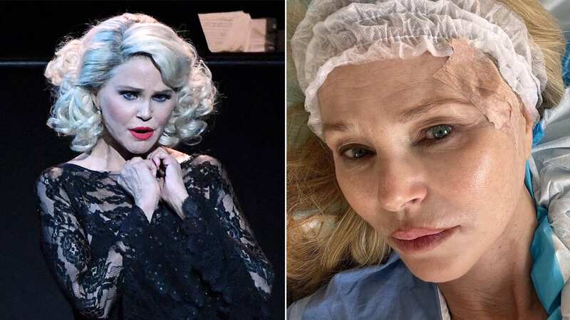 Christie Brinkley shares skin cancer diagnosis