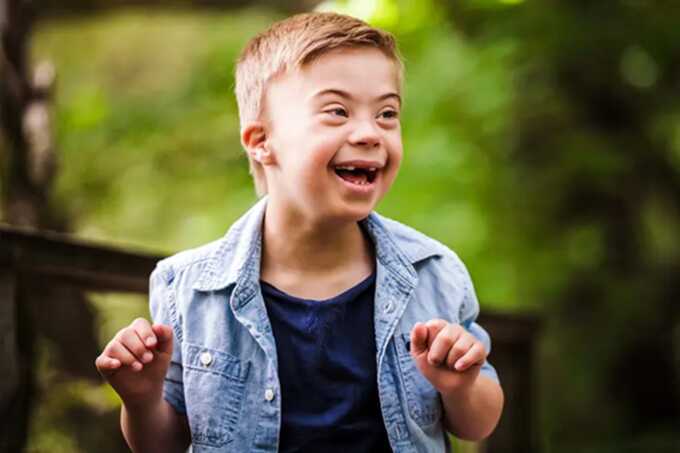 Breakthrough in Down syndrome treatment: scientists succeed in removing extra 21st chromosome