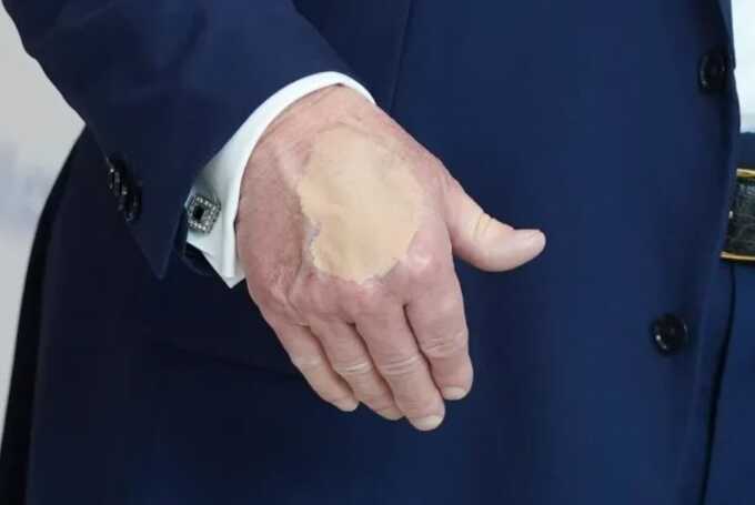 Trump spotted with makeup on hand amid health speculation