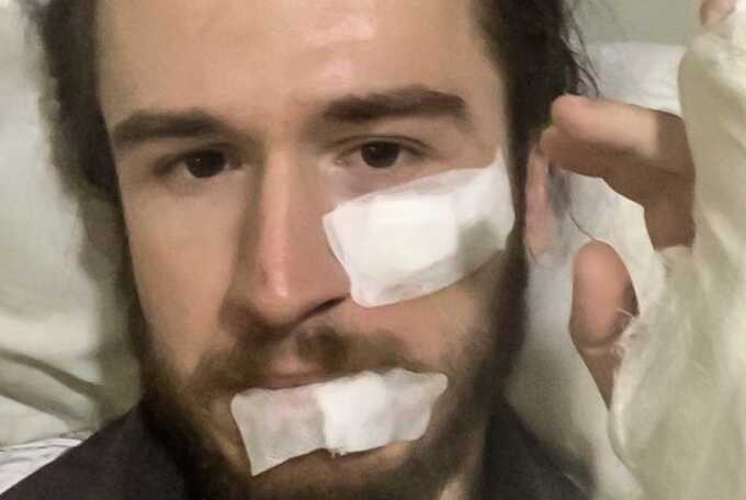 Violence erupts at Tbilisi mayoral campaign: journalists and protesters assaulted
