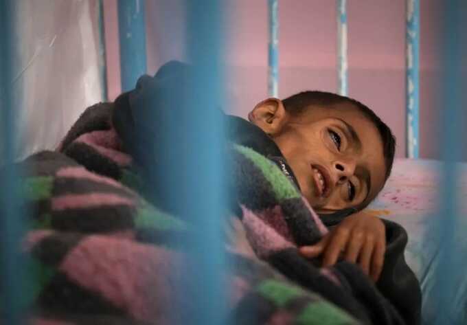 9,300 children hospitalised for acute malnutrition in Gaza despite ceasefire — UN
