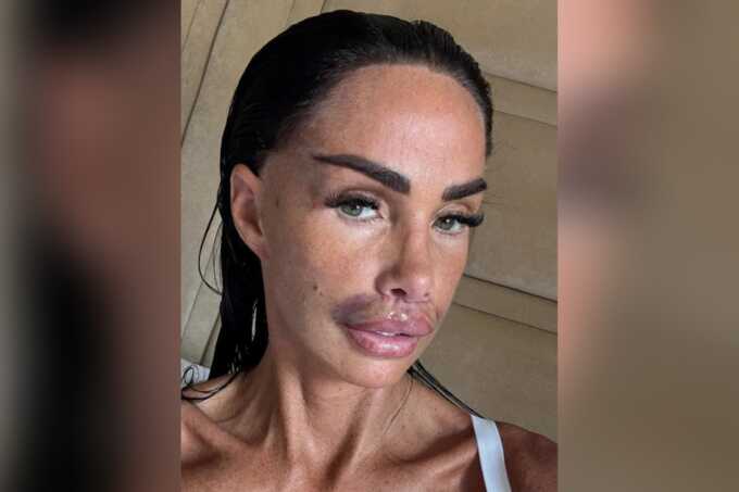 Reality star Katie Price sparks concern after appearing injured on set