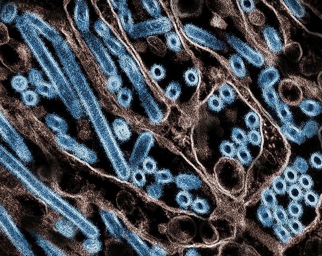 (FILES) This undated handout image obtained on November 22, 2024, courstesy of the Centers for Disease Control and Prevention (CDC) and the National Institute of Allergy and Infectious Diseases shows a colorized transmission electron micrograph of avian influenza A H5N1 virus particles (blue), grown in Madin-Darby Canine Kidney (MDCK) epithelial cells. The first human death linked to bird flu has been reported in the United States, health authorities in the state of Louisiana said January 6, 2024, adding that the patient was elderly and suffered from other pathologies. The patient, aged over 65, had been hospitalized for a respiratory ailment, and was the first serious case of human infection of the H5N1 virus to be detected in the United States. (Photo by HANDOUT / National Institute of Allergy and Infectious Diseases / AFP) / RESTRICTED TO EDITORIAL USE - MANDATORY CREDIT "AFP PHOTO /CENTERS FOR DISEASE CONTROL AND PREVENTION AND NATIONAL INSTITUTE OF ALLERGY AND INFECTIOUS DISEASES " - NO MARKETING NO ADVERTISING CAMPAIGNS - DISTRIBUTED AS A SERVICE TO CLIENTS (Photo by HANDOUT/National Institute of Allergy and Infectious Diseases/AFP via Getty Images) dqxikeidqkikdinv